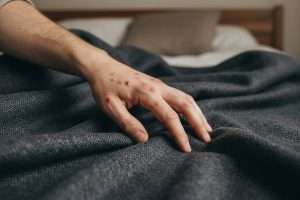 Piqûre la nuit sans punaises : qui sont les coupables ?